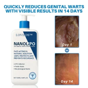💥LOVILDS™NanoLipo HPV Genital Warts Eraser Cream🌿