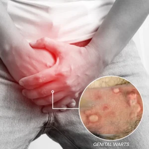 💥LOVILDS™NanoLipo HPV Genital Warts Eraser Cream🌿