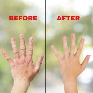 NESLEMY™ Soothing Skin Relief Cream | Calm & Comfort