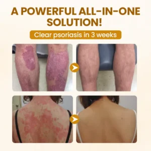 Timilk® BeeVenom Complex Repair Cream