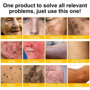 LOVILDS™ 🐝 Bee Venom Skin Restoration Cream 🐝