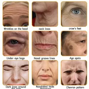 LOVILDS™ 🐝 Bee Venom Skin Restoration Cream 🐝