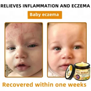 LOVILDS™ 🐝 Bee Venom Skin Restoration Cream 🐝