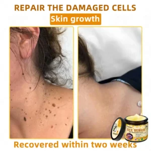 LOVILDS™ 🐝 Bee Venom Skin Restoration Cream 🐝
