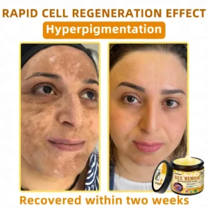 LOVILDS™ 🐝 Bee Venom Skin Restoration Cream 🐝