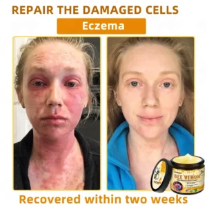 LOVILDS™ 🐝 Bee Venom Skin Restoration Cream 🐝