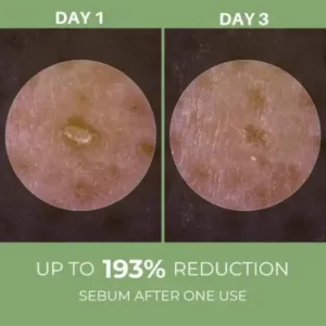 LOVILDS® Rice Peel Ampoule