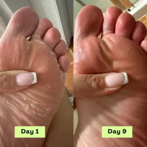 💫Limited-time offer: 💪55% off NESLEMY® AntiFungal Relief Soap Bar💫-----