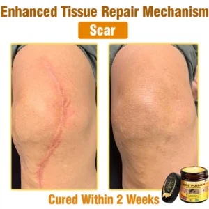 𝐋𝐎𝐕𝐈𝐋𝐃𝐒™ 𝐁𝐞𝐞 𝐏𝐨𝐢𝐬𝐨𝐧 𝐀𝐥𝐥-𝐢𝐧-𝐎𝐧𝐞 𝐂𝐫𝐞𝐚𝐦–🌸 Anti-aging,Hydrating, Skin Repair, Even Tone, Acne and Dark Spot Treatment, Wart and Mole Removal, Psoriasis Relief