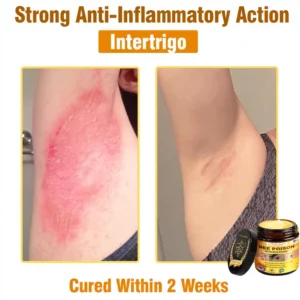 𝐋𝐎𝐕𝐈𝐋𝐃𝐒™ 𝐁𝐞𝐞 𝐏𝐨𝐢𝐬𝐨𝐧 𝐀𝐥𝐥-𝐢𝐧-𝐎𝐧𝐞 𝐂𝐫𝐞𝐚𝐦–🌸 Anti-aging,Hydrating, Skin Repair, Even Tone, Acne and Dark Spot Treatment, Wart and Mole Removal, Psoriasis Relief