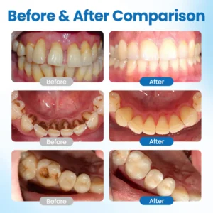 Biancat® EnaMend Nano-Fusion Tooth Defense Serum