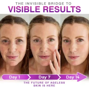 LOVILDS® 3-in-1 Microneedle Anti-Aging Patch