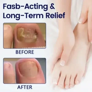 LOVILDS™ Anti-Fungal Nail Repair Patch