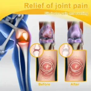 LOVILDS™ Bee Poison Pain-Relief Bone Healing Cream (Specially for older adults)