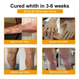 LOVILDS™ Bee Poison Pain-Relief Bone Healing Cream (Specially for older adults)