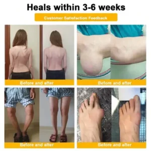 LOVILDS™ Bee Poison Pain-Relief Bone Healing Cream (Specially for older adults)