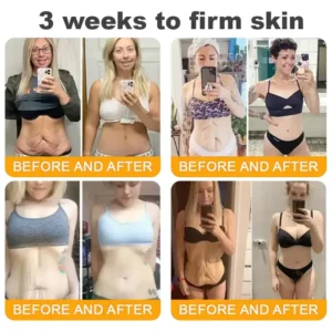 LOVILDS™ 🐝Bee Poison Skin Restoration Cream 🐝