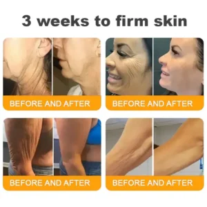 LOVILDS™ 🐝Bee Poison Skin Restoration Cream 🐝