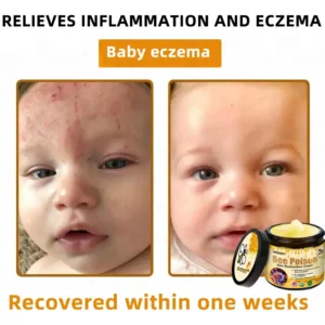 LOVILDS™ 🐝Bee Poison Skin Restoration Cream 🐝