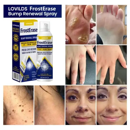 LOVILDS™ FrostErase Bump Renewal Spray