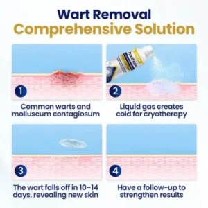 LOVILDS™ FrostErase Bump Renewal Spray