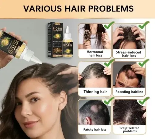 LOVILDS® Highly Effective Biotin & Rosemary Hair Growth Serum
