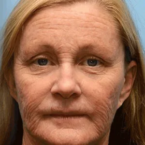 🧠👨‍⚕️Made and shipped from the USA 💫LOVILDS® moringa & Vita-A Retinol Shot Wrinkle-Lift Tightening cream - Last Day Promotion 50% OFF