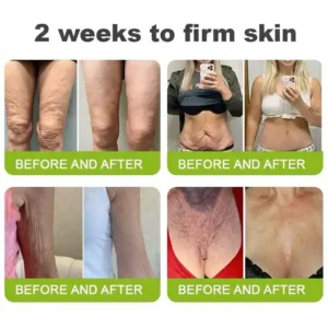 🧠👨‍⚕️Made and shipped from the USA 💫LOVILDS® moringa & Vita-A Retinol Shot Wrinkle-Lift Tightening cream - Last Day Promotion 50% OFF