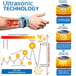 🧑‍⚕️NESLEMY™ Ultrasonic Fat Blasting and Detoxing Wristband B