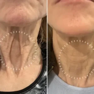 Ourlyard® Bee venom Pro Comprehensive Cream