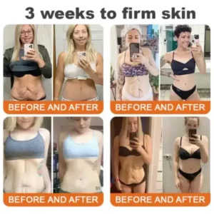 Ourlyard® Bee venom Pro Comprehensive Cream