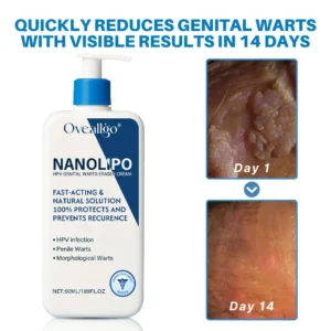 Oveallgo® NanoLipo HPV Genital Warts Eraser Cream ProX