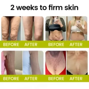 Timilk® Botox Retinol Shot Smoother-Looking Skin for Deep Lines, Sagging Jowls Puffy Eyes